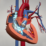 cardiovascular surgery